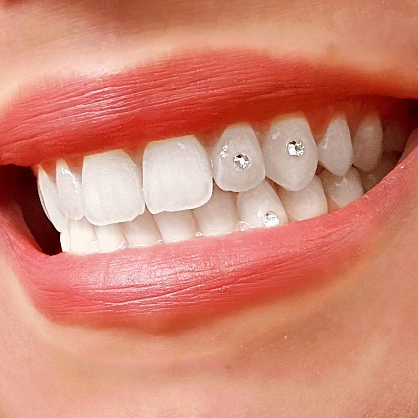 Tooth Gems