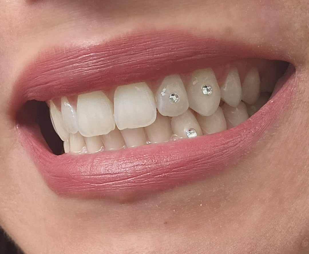DYI Tooth Gem Kit