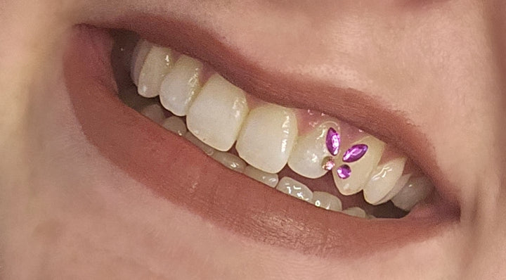Butterfly Tooth Gem in Pink