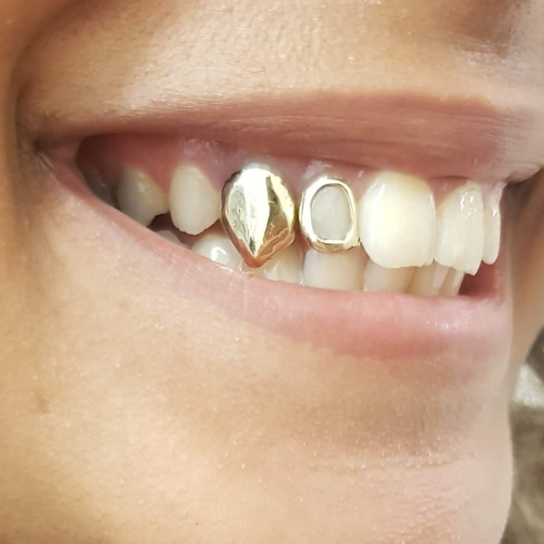 all silver teeth