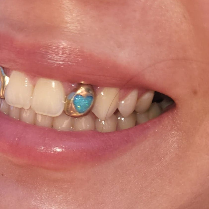 Enamel Heart (Opal effect) single cap *Any colour*