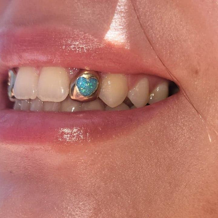 Enamel Heart (Opal effect) single cap *Any colour*