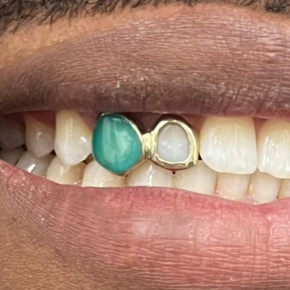 Enamel (Opal effect) cap *Any colour* and Window set