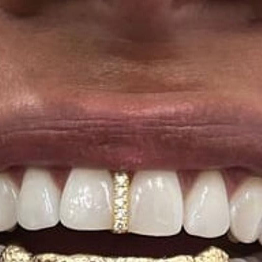 Diamond Gap filler/ Strip Design