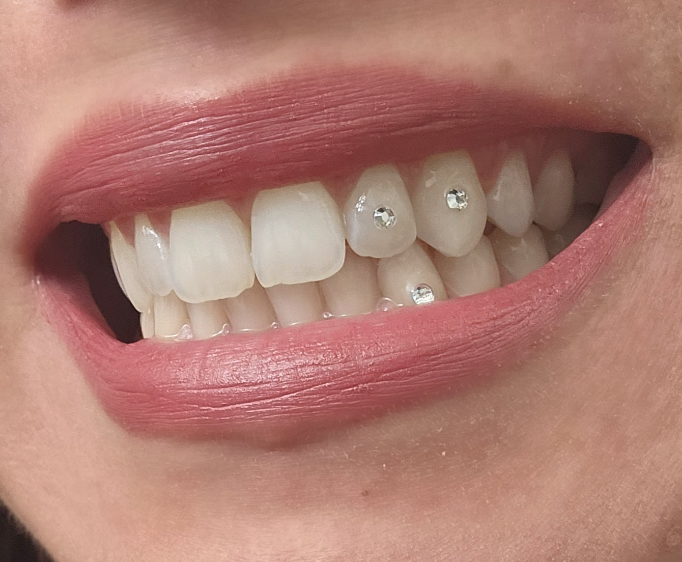 Temporary tooth gem kit – London Grillz