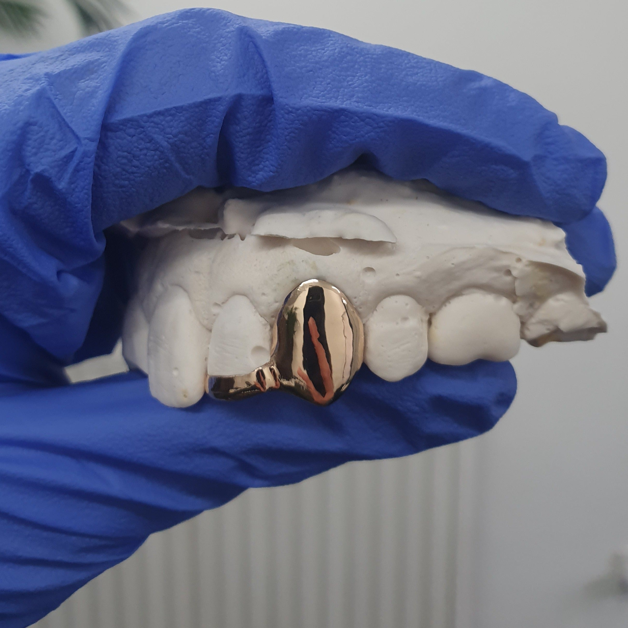 Single cap with inlay, grillz, silver caps – London Grillz