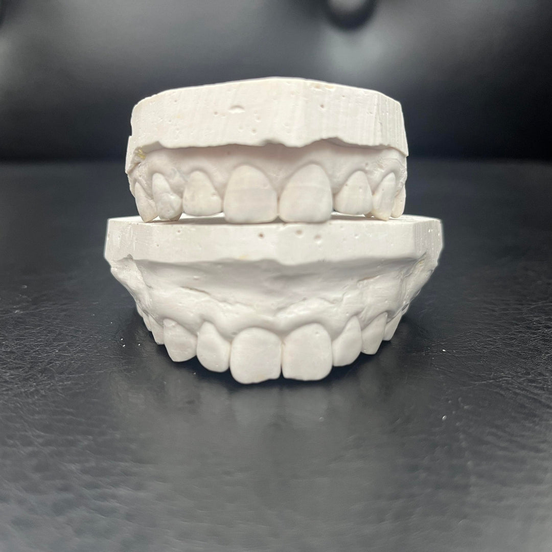 Keep your moulds