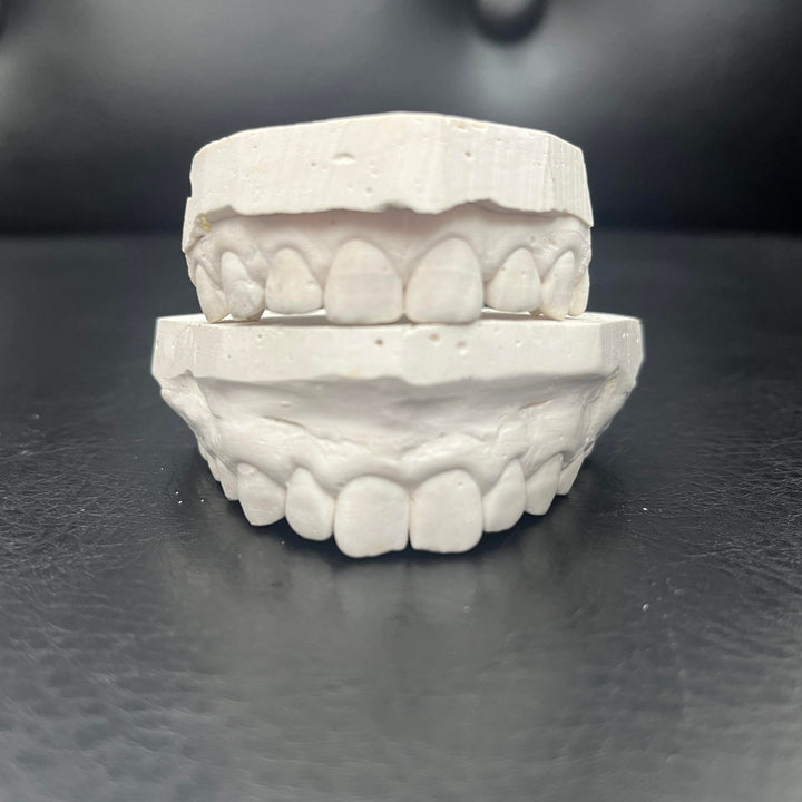 Keep your moulds