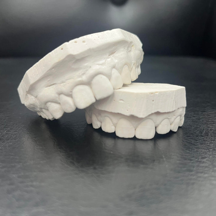 Keep your moulds