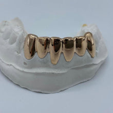 Load image into Gallery viewer, Six Set of Grillz
